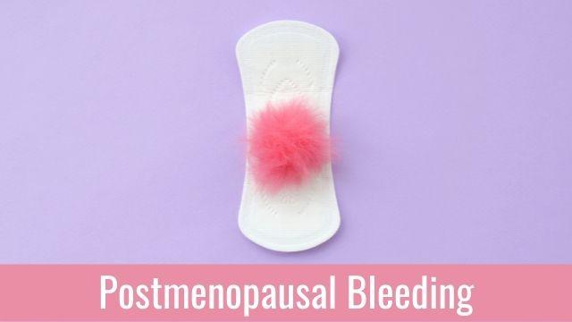 Ananthapuri Hospitals & Research Institute - 1. WHAT IS POSTMENOPAUSAL  BLEEDING (PMB)? Menopause is the time in the life of a woman when she stops  having periods at least for one year.