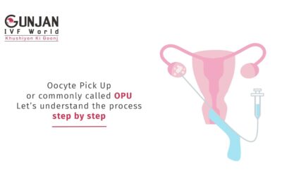 How is an OPU or Ovum Pick-up done?